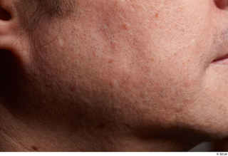 HD Face Skin Kevin Sarmiento cheek chin face skin pores…